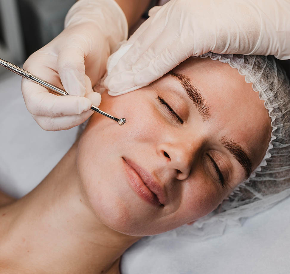 Gözenek Tedavisi Nedir?