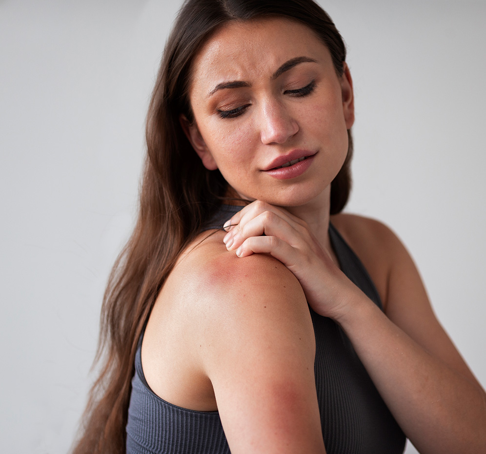 Güneş Alerjisi Nedir? Belirtileri Nelerdir?