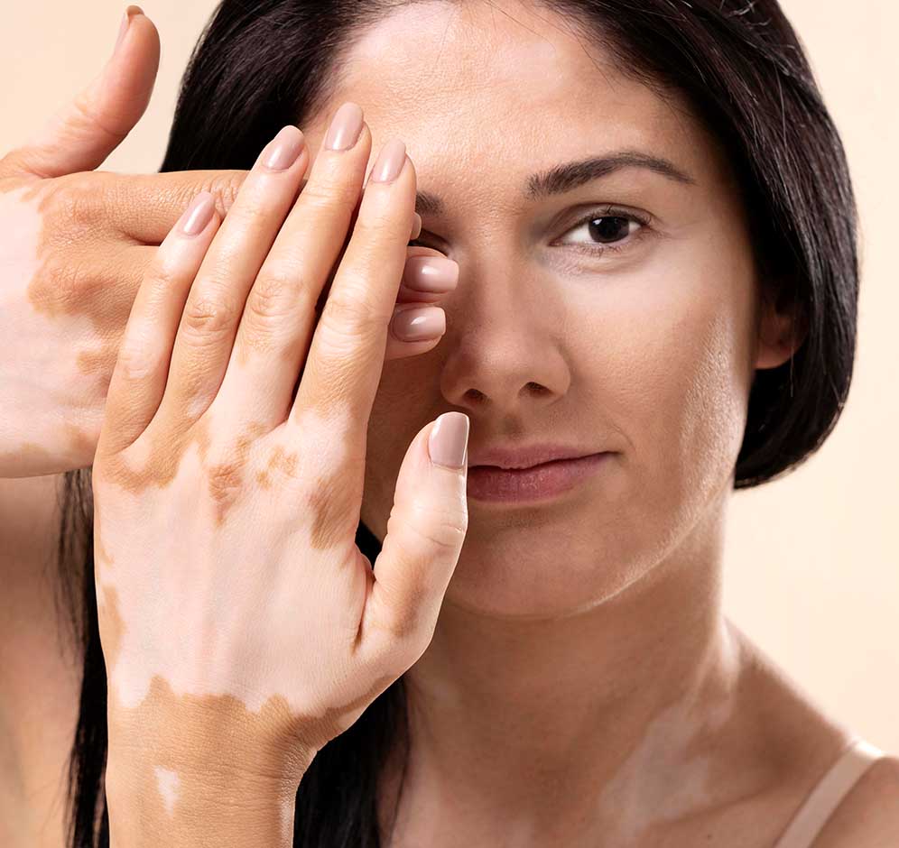 Hasarlı Bir Cilt Bariyeri Nasıl Onarılır?